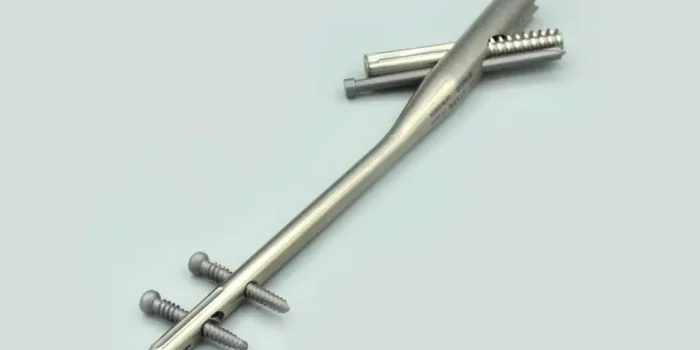 Is-Intramedullary-Nail-Permanent-2